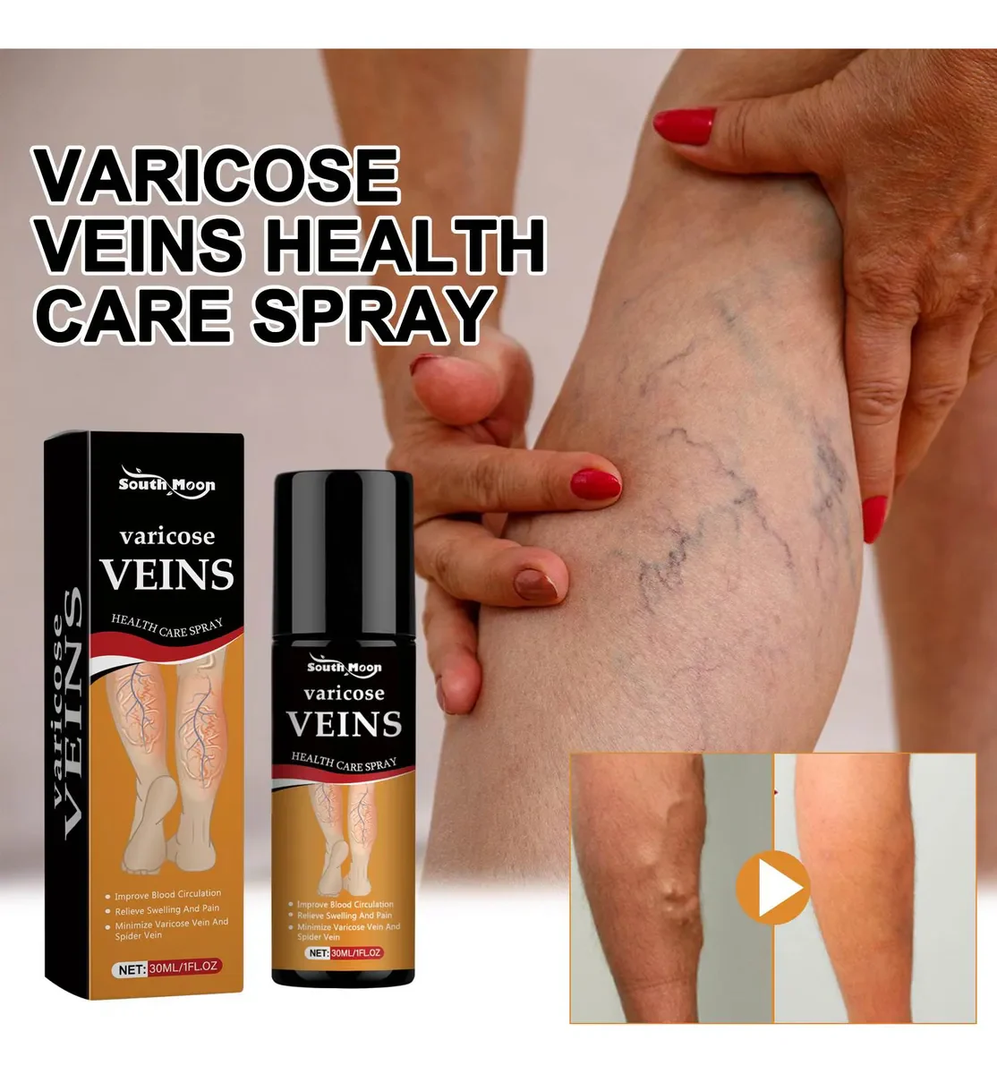 Vein Healing Varicose Veins Treatment Spray Pack of 2
