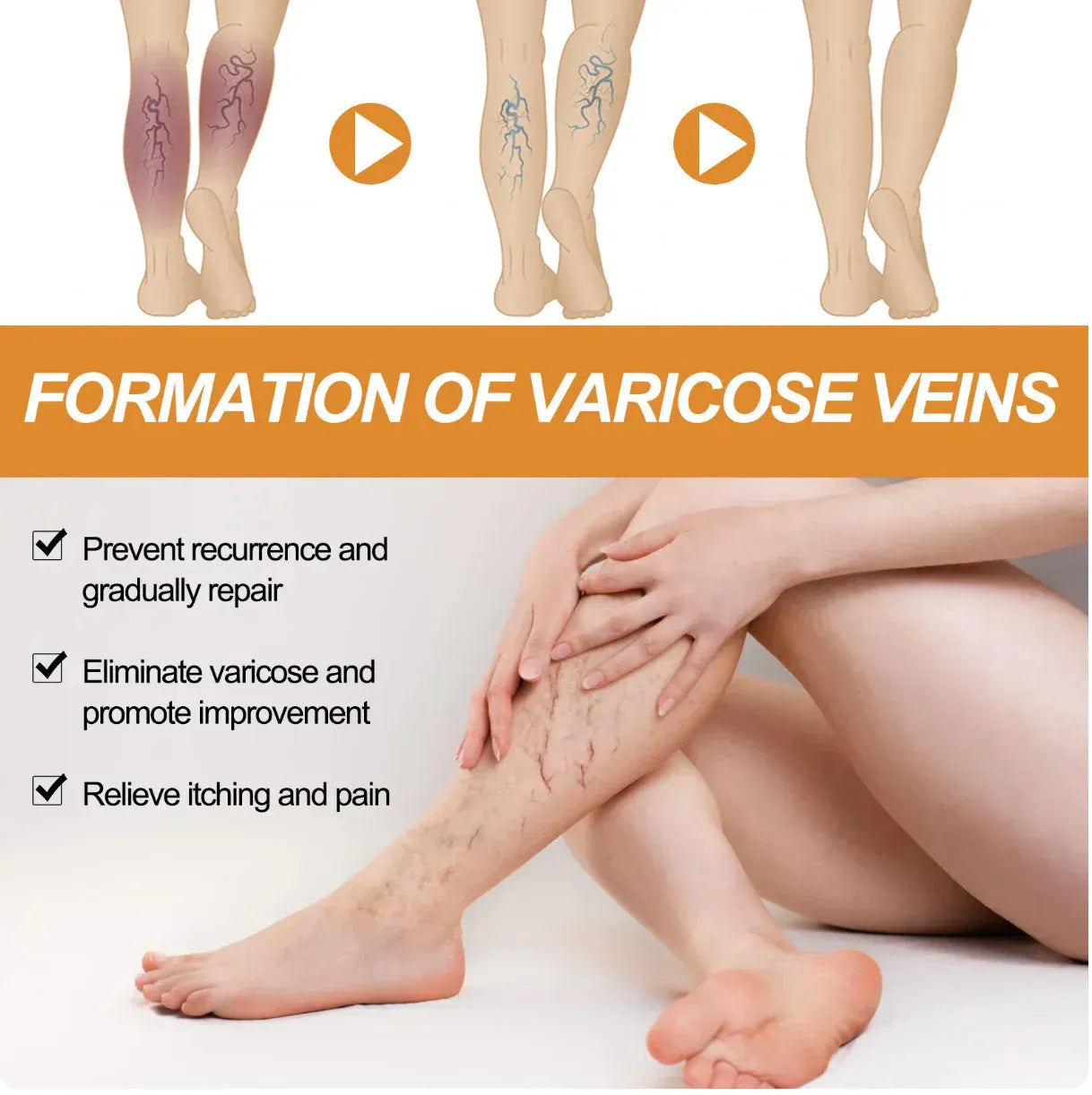 Vein Healing Varicose Veins Treatment Spray Pack of 2
